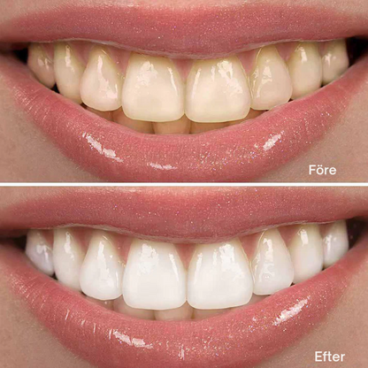 Shyné™ - Let your smile shine.