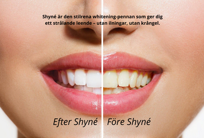 Shyné™ - Let your smile shine.